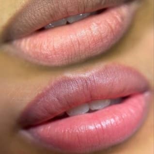 Lip Neutralization Package at SR Beauty Studios in Sacramento, CA